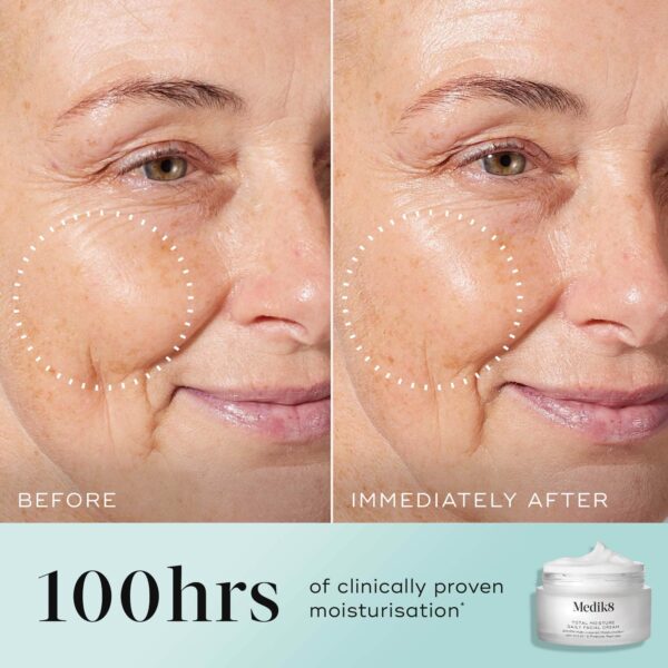 Total Moisture Daily Facial Cream™ - Image 4