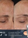 Crystal Retinal® - Image 3